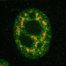 Endogenous Jmjd6 (green) and splice factor SC35 (red) in HeLa cells